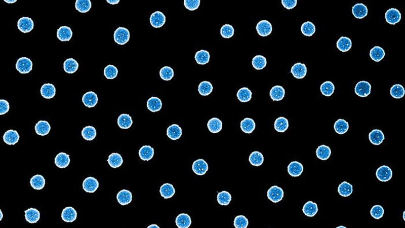 Microscope image of platinum particles. Picture credit: Chalmers University of Technology | Athanasios Theodoridis